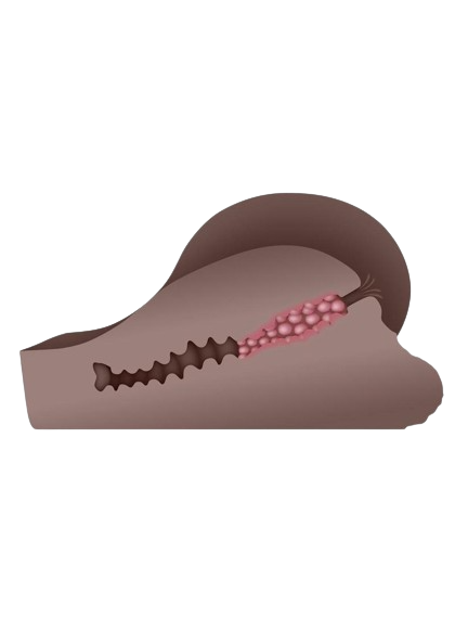 Gender X Handful Anal Masturbator